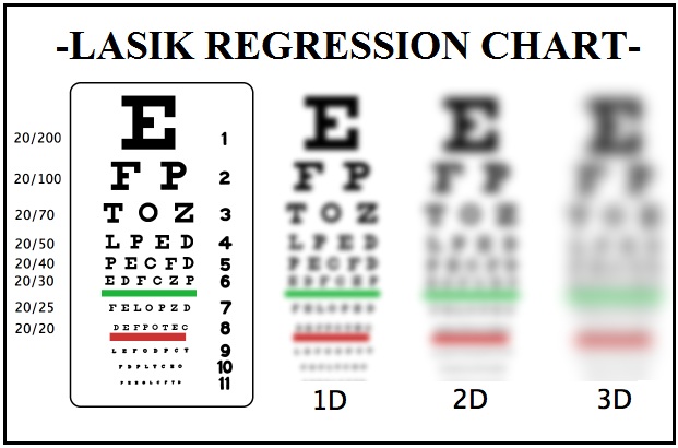 Free Eye Chart - Download Print and Test